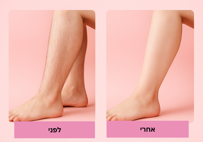 מכשיר הסרת שיער 4 ב־1